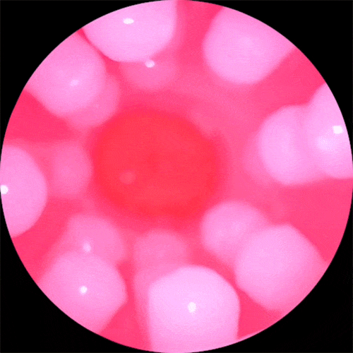 Cấu trúc nhú đặc trưng của NPG Miiko