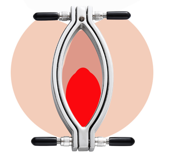 Dụng cụ kích thích môi âm đạo bằng xung điện