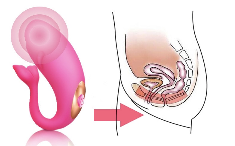 Trứng rung không dây cá heo điều khiển từ xa kích thích điểm G